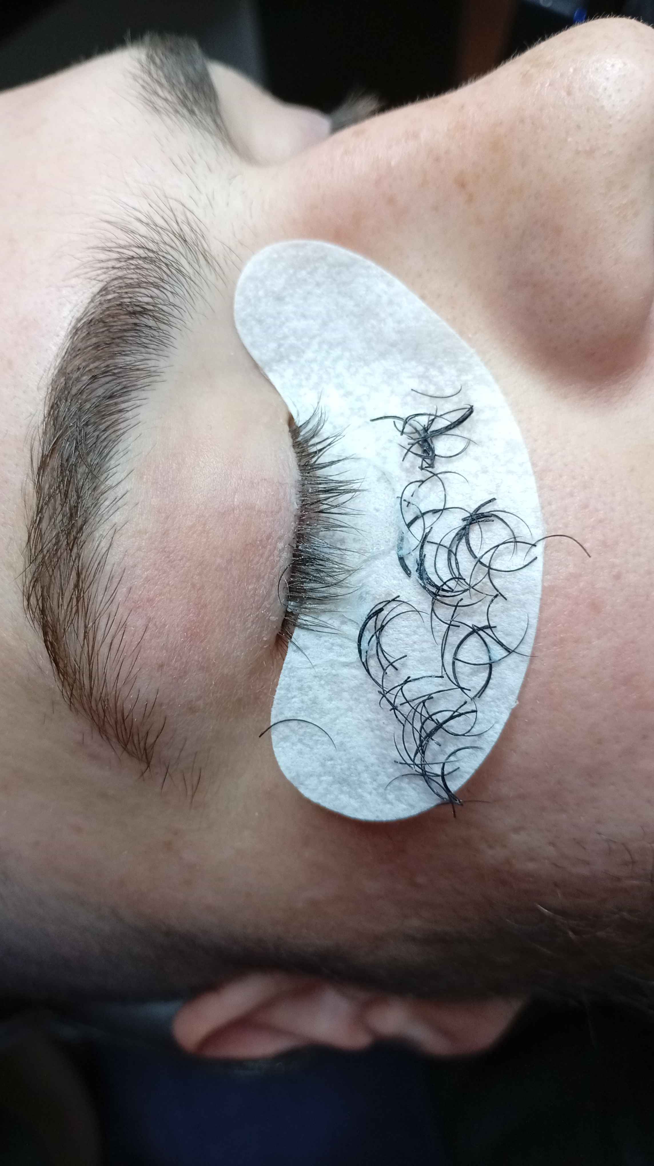 Remoção das extensões 